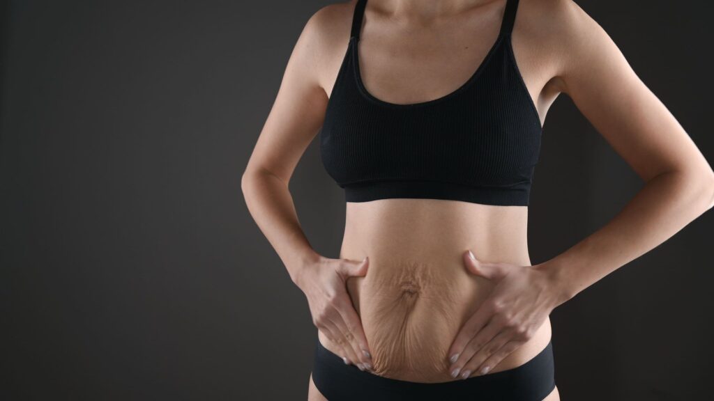 7 Dicas Infalíveis para Eliminar a Barriga Flácida do Pós-Parto